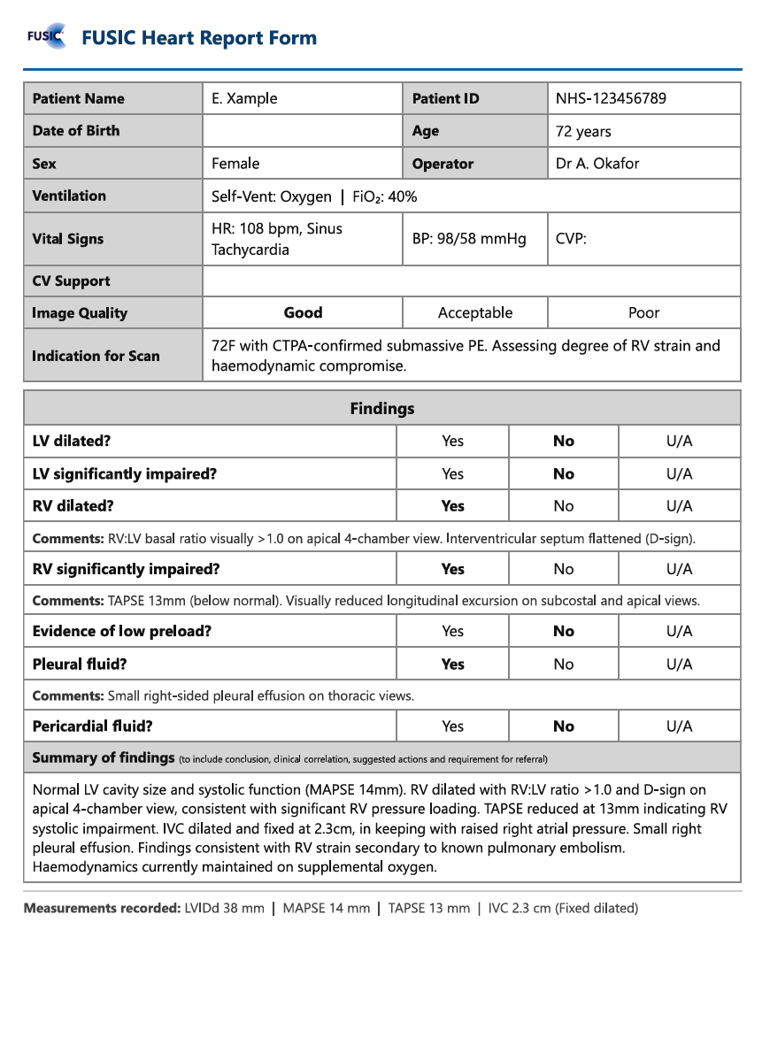 Example FUSIC Heart PDF report